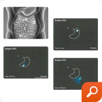 DRcaps® in vivo disintegration